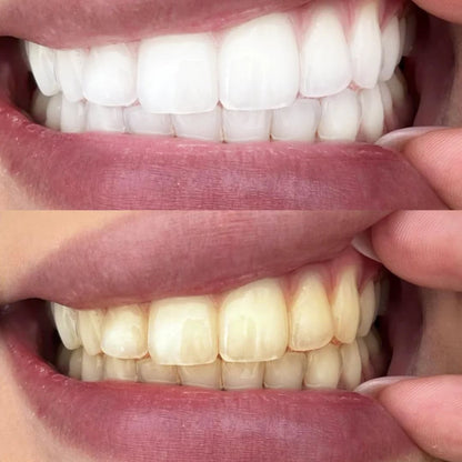 Sonrisa Perfecta